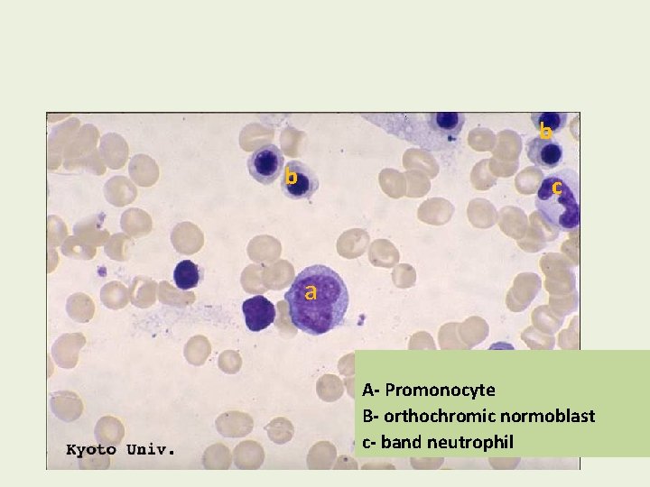 b b c a A- Promonocyte B- orthochromic normoblast c- band neutrophil 