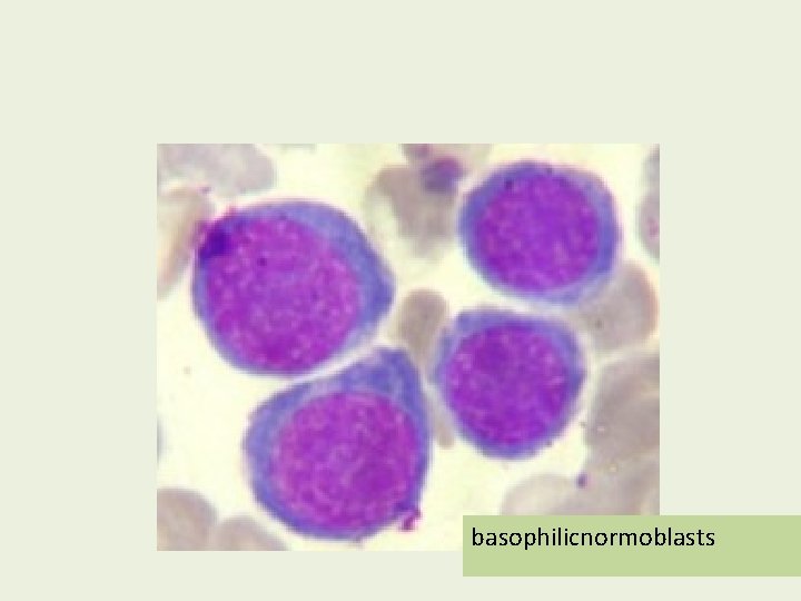 basophilicnormoblasts 