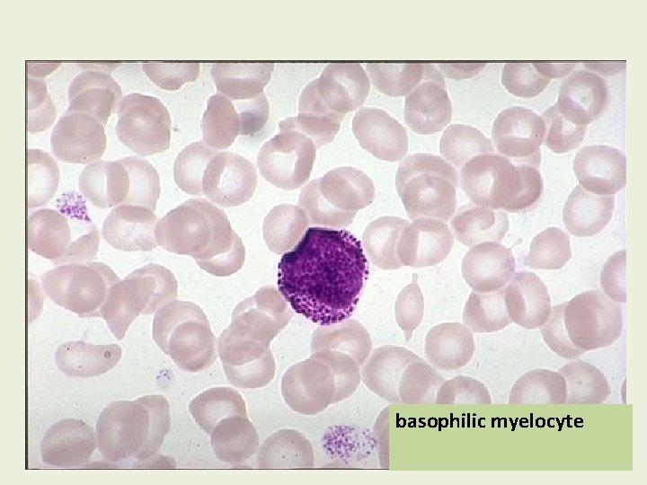 basophilic myelocyte 