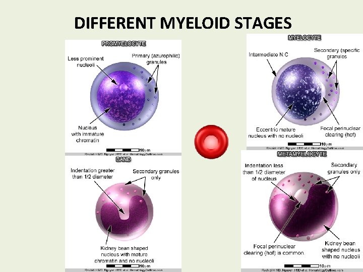 DIFFERENT MYELOID STAGES 