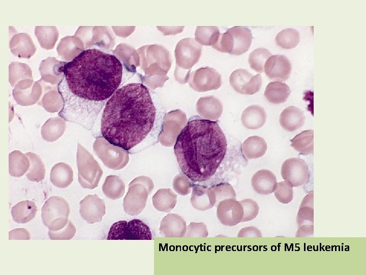 Monocytic precursors of M 5 leukemia 