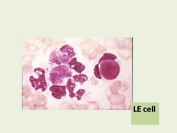 LE cell 