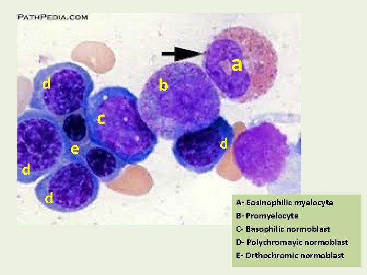 a b d c e d d d A- Eosinophilic myelocyte B- Promyelocyte C-