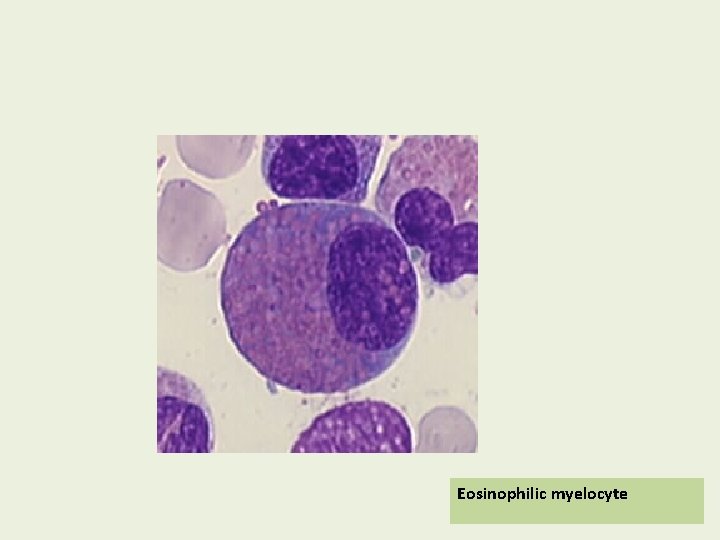 Eosinophilic myelocyte 