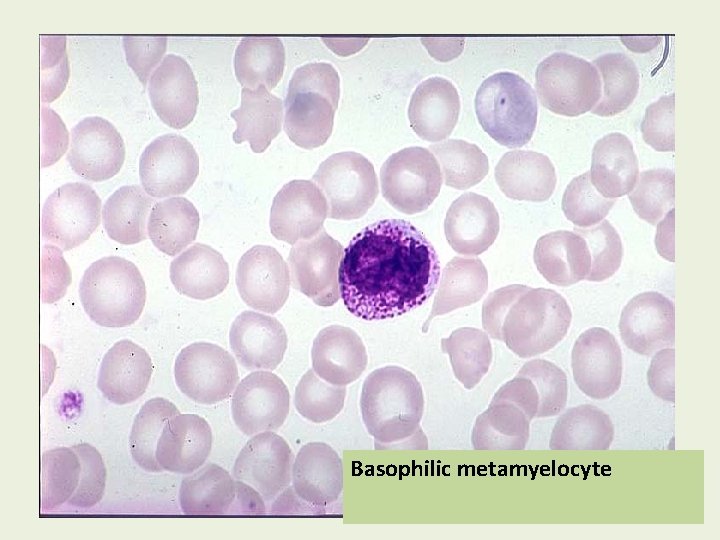 Basophilic metamyelocyte 