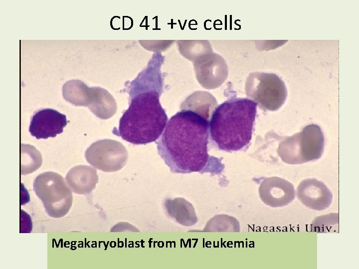 CD 41 +ve cells Megakaryoblast from M 7 leukemia 
