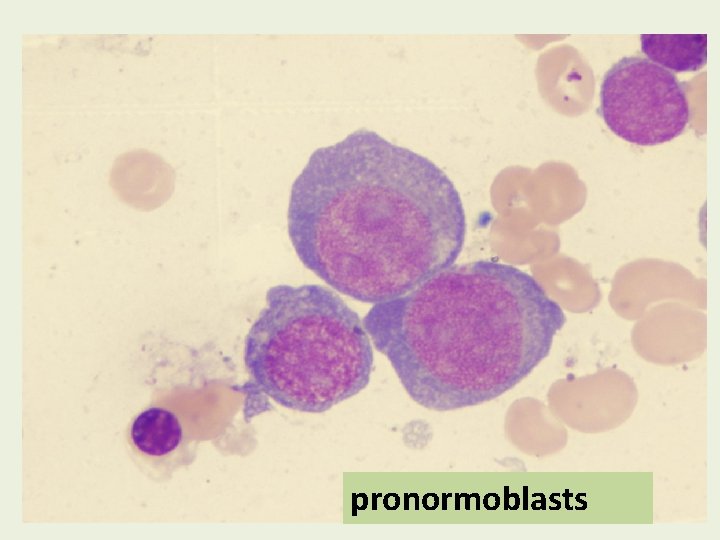 pronormoblasts pronormoblasts