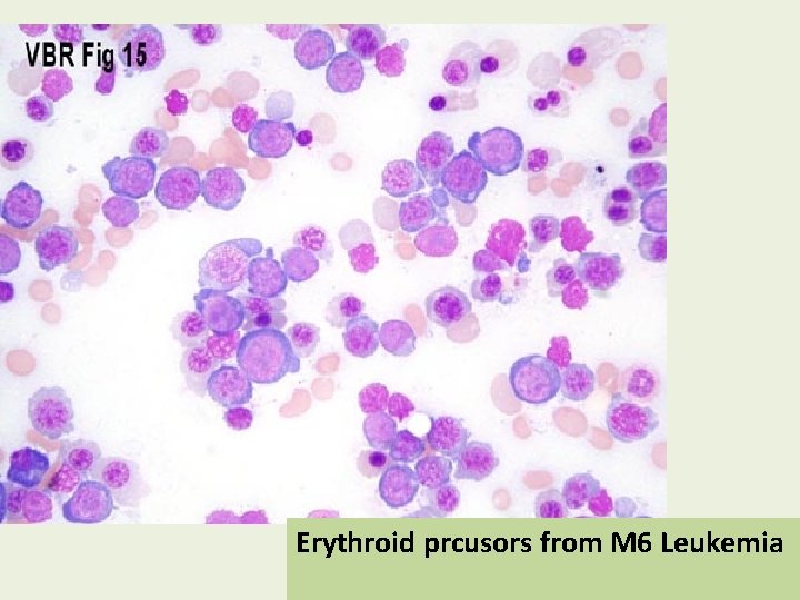 Erythroid prcusors from M 6 Leukemia 