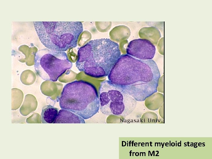 Different myeloid stages from M 2 