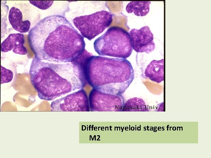 Different myeloid stages from M 2 