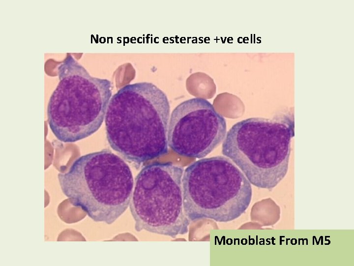 Non specific esterase +ve cells Monoblast From M 5 