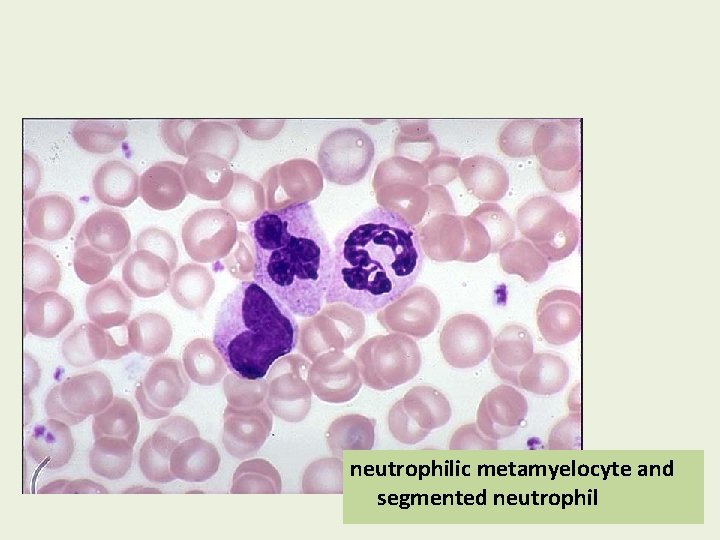 neutrophilic metamyelocyte and segmented neutrophil 