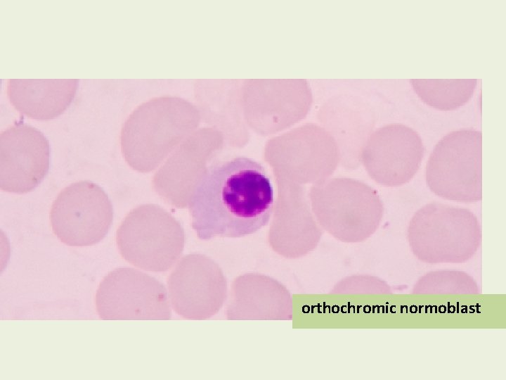 orthochromic normoblast 