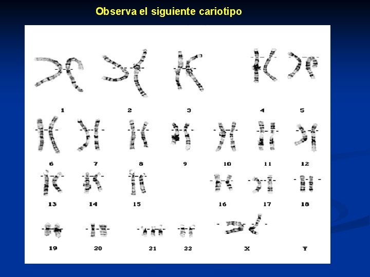 Observa el siguiente cariotipo 