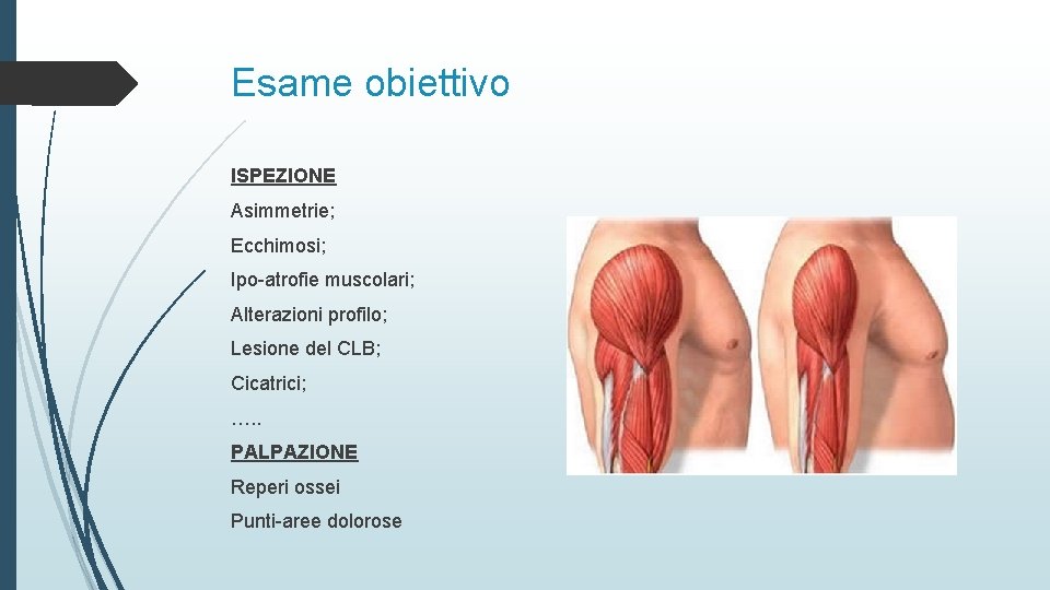 Esame obiettivo ISPEZIONE Asimmetrie; Ecchimosi; Ipo-atrofie muscolari; Alterazioni profilo; Lesione del CLB; Cicatrici; ….