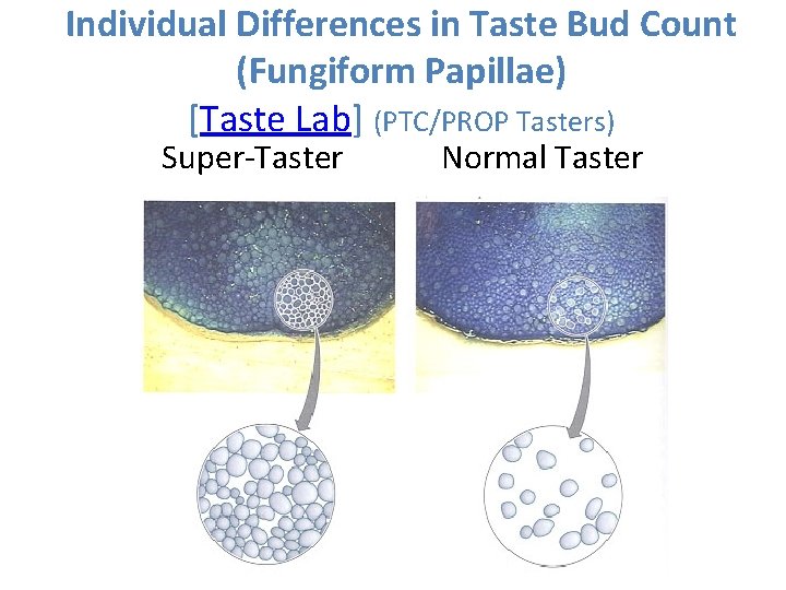 Individual Differences in Taste Bud Count (Fungiform Papillae) [Taste Lab] (PTC/PROP Tasters) Super-Taster Normal