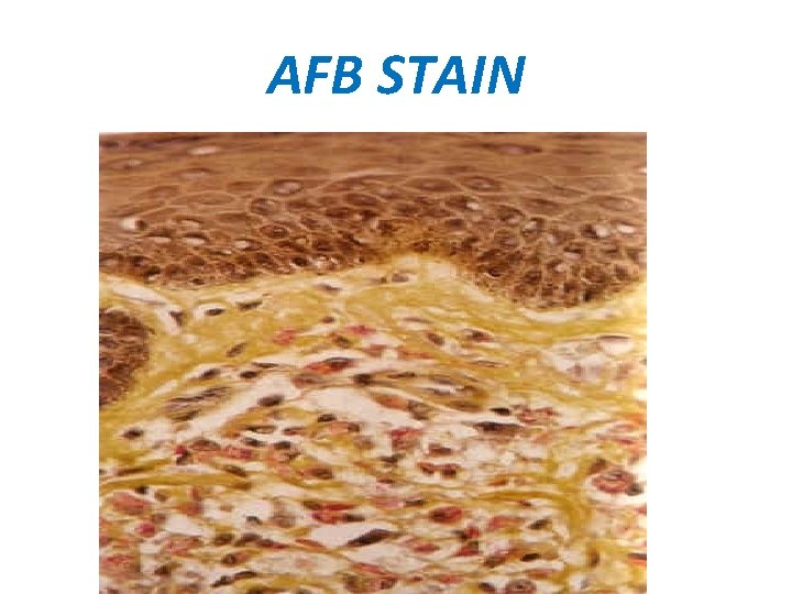 AFB STAIN 