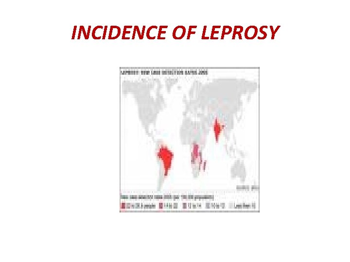 INCIDENCE OF LEPROSY 