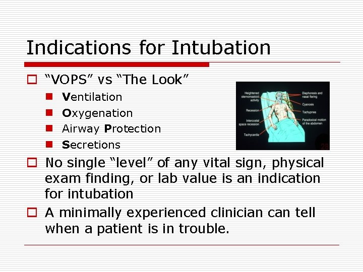 Indications for Intubation o “VOPS” vs “The Look” n n Ventilation Oxygenation Airway Protection