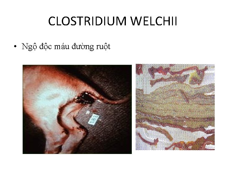 CLOSTRIDIUM WELCHII • Ngộ độc máu đường ruột 