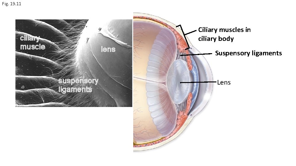 Fig. 19. 11 Ciliary muscles in ciliary body Suspensory ligaments Lens 