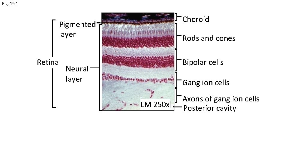Fig. 19. 11 Choroid Pigmented layer Retina Rods and cones Bipolar cells Neural layer
