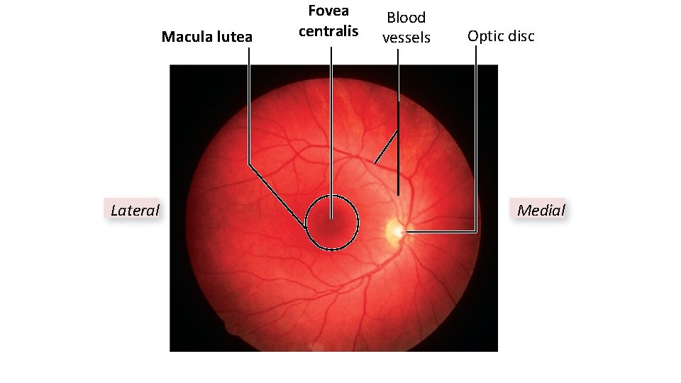 Macula lutea Lateral Fovea centralis Blood vessels Optic disc Medial 