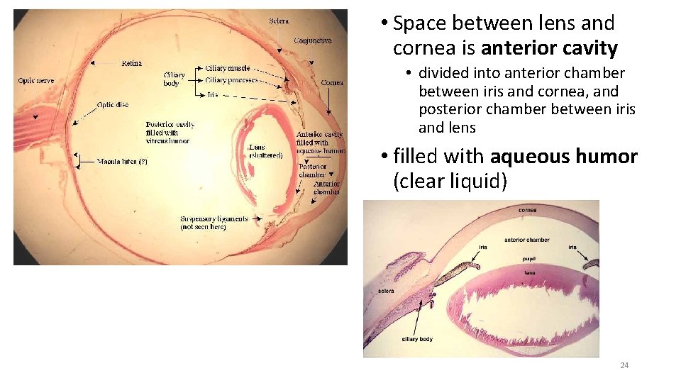  • Space between lens and cornea is anterior cavity • divided into anterior