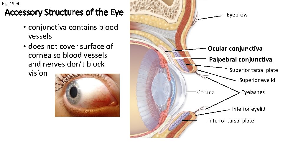 Fig. 19. 9 b Accessory Structures of the Eye • conjunctiva contains blood vessels