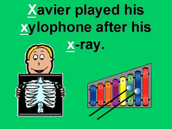 Xavier played his xylophone after his x-ray. 