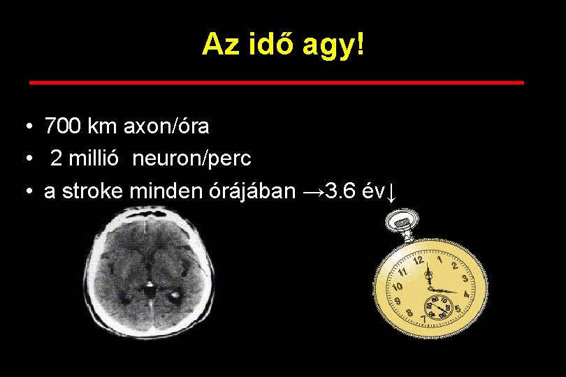 Az idő agy! • 700 km axon/óra • 2 millió neuron/perc • a stroke