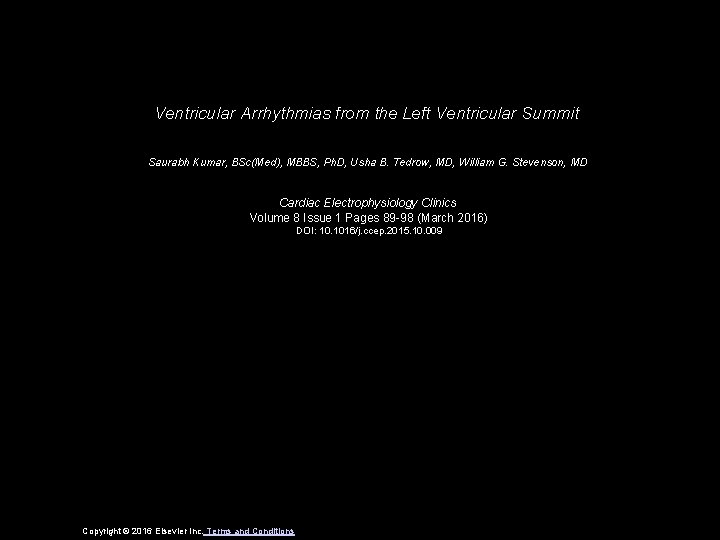 Ventricular Arrhythmias from the Left Ventricular Summit Saurabh Kumar, BSc(Med), MBBS, Ph. D, Usha