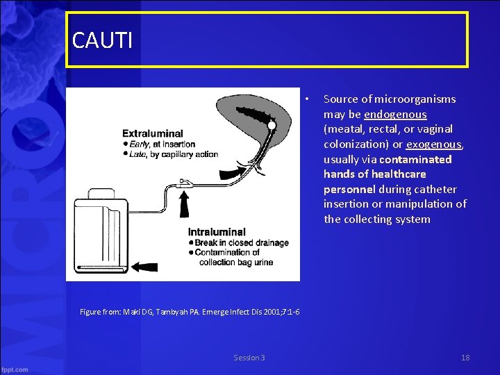 CAUTI • Source of microorganisms may be endogenous (meatal, rectal, or vaginal colonization) or