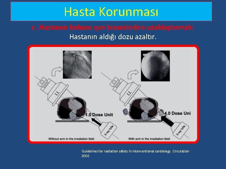 Hasta Korunması c. Hastanın kolunu ışın trasesinden uzaklaştırmak: Hastanın aldığı dozu azaltır. Guidelines for Hasta Korunması c. Hastanın kolunu ışın trasesinden uzaklaştırmak: Hastanın aldığı dozu azaltır. Guidelines for