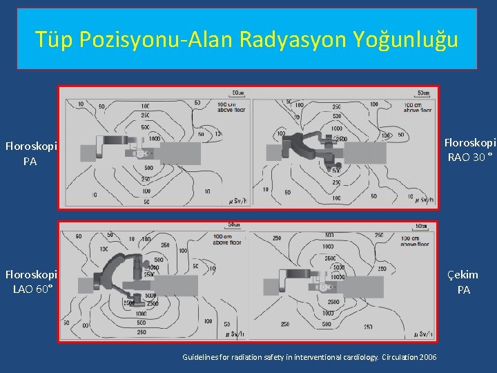 Tüp Pozisyonu-Alan Radyasyon Yoğunluğu Floroskopi RAO 30 ° Floroskopi PA Floroskopi LAO 60° Çekim Tüp Pozisyonu-Alan Radyasyon Yoğunluğu Floroskopi RAO 30 ° Floroskopi PA Floroskopi LAO 60° Çekim