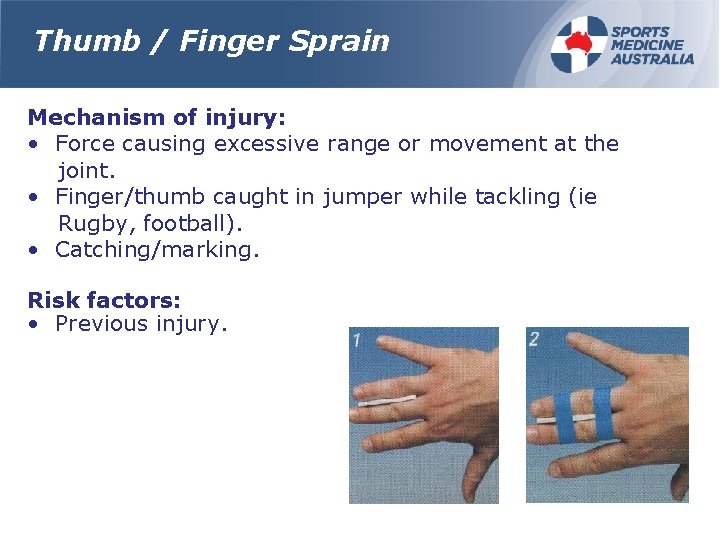 Thumb / Finger Sprain Mechanism of injury: • Force causing excessive range or movement