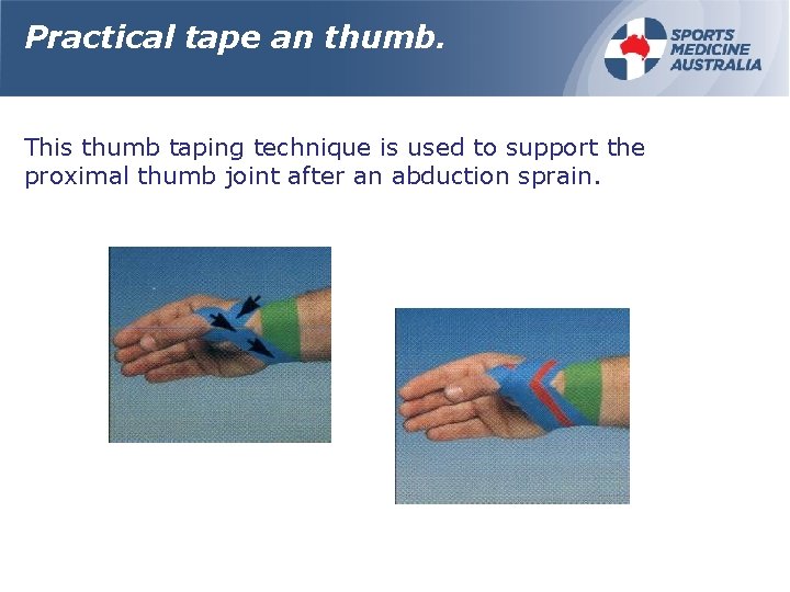 Practical tape an thumb. This thumb taping technique is used to support the proximal
