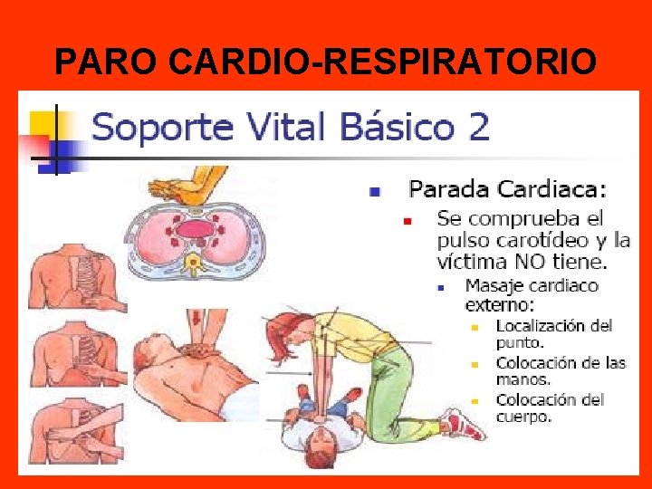 PARO CARDIO-RESPIRATORIO 