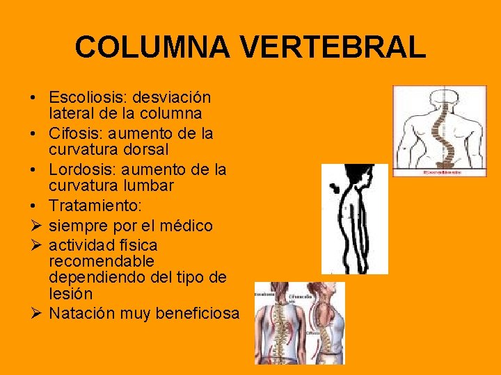 COLUMNA VERTEBRAL • Escoliosis: desviación lateral de la columna • Cifosis: aumento de la