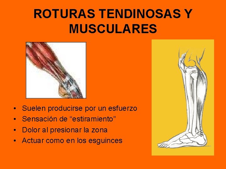 ROTURAS TENDINOSAS Y MUSCULARES • • Suelen producirse por un esfuerzo Sensación de “estiramiento”