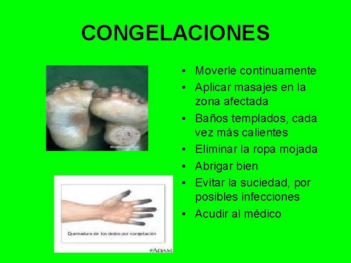 CONGELACIONES • Moverle continuamente • Aplicar masajes en la zona afectada • Baños templados,
