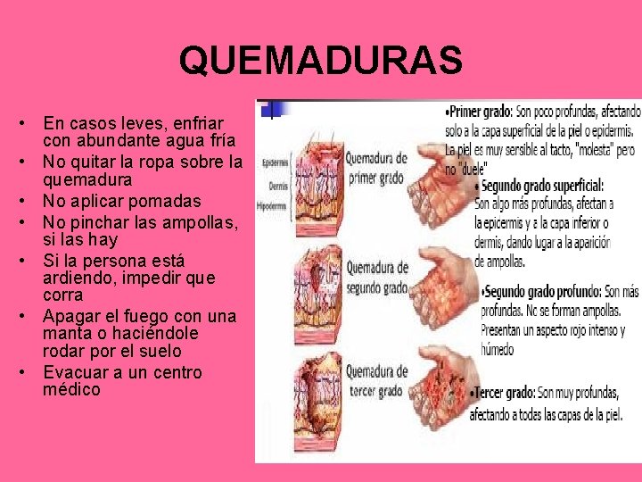 QUEMADURAS • En casos leves, enfriar con abundante agua fría • No quitar la