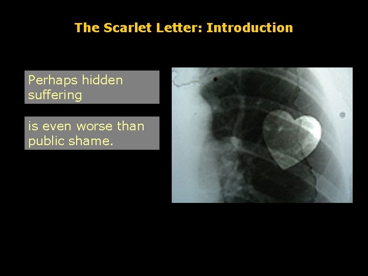 The Scarlet Letter: Introduction Perhaps hidden suffering is even worse than public shame. 