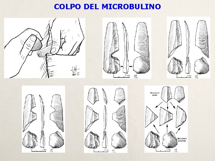 COLPO DEL MICROBULINO 