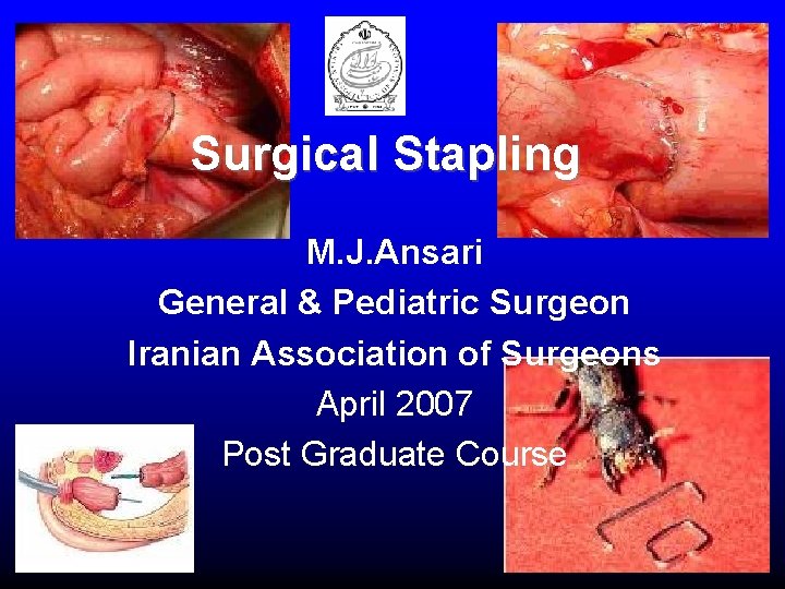 Surgical Stapling M. J. Ansari General & Pediatric Surgeon Iranian Association of Surgeons April