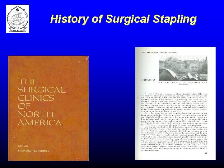 History of Surgical Stapling 