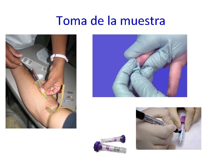 Toma de la muestra 