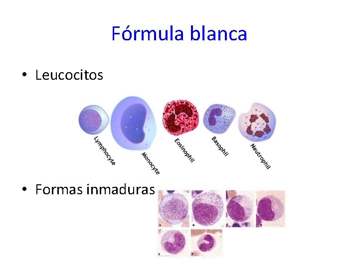 Fórmula blanca • Leucocitos • Formas inmaduras 