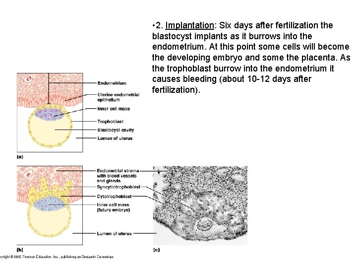  • 2. Implantation: Six days after fertilization the blastocyst implants as it burrows