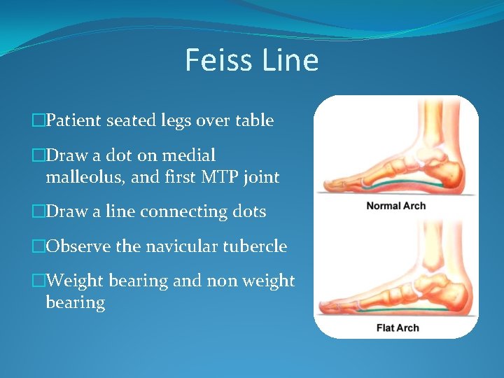 Feiss Line �Patient seated legs over table �Draw a dot on medial malleolus, and